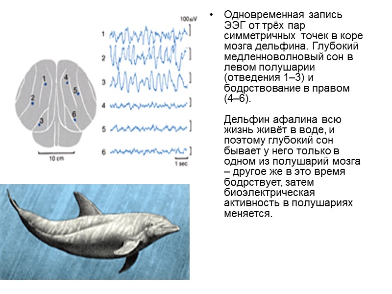 Одновременная запись ЭЭГ от трёх пар симметричных точек в коре мозга дельфина. Глубокий медленноволновый
